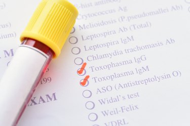 Toxoplasma test