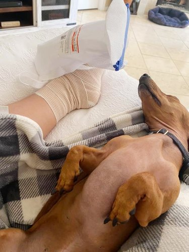 weiner dog sleeps next to injured woman