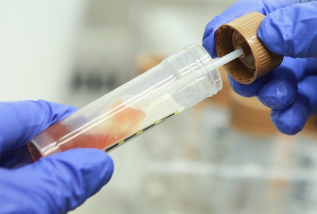 Health Authorities Seek Clues To EHEC Outbreak