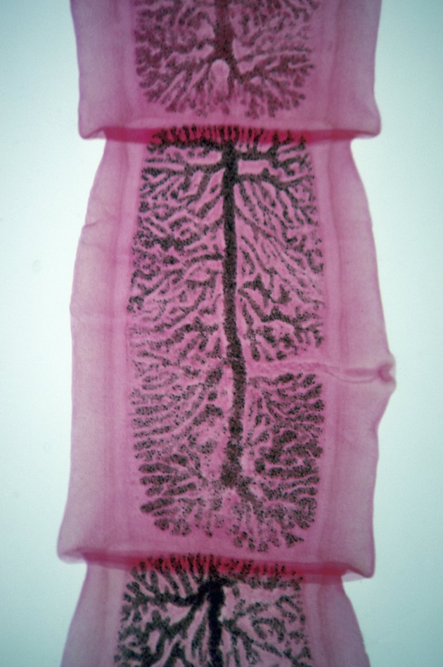 Gravid Proglottid, Dog Tapeworm (Taenia pisiformis), 4X at 35mm. Shows a highly branched uterus with fertilized eggs (zygotes). Remnants of sperm duct, vagina and genital pore still visible. Flatworm, hermaphrodite.