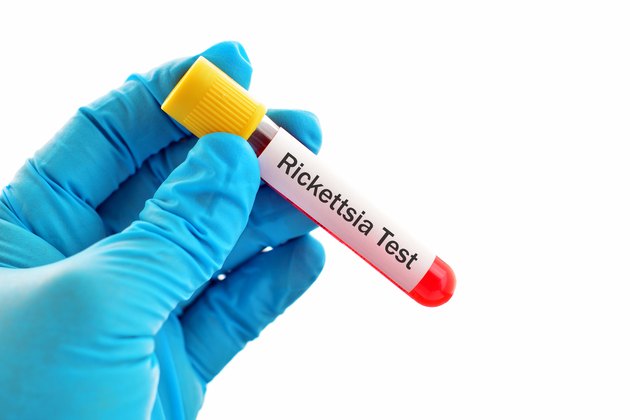 Rickettsia test