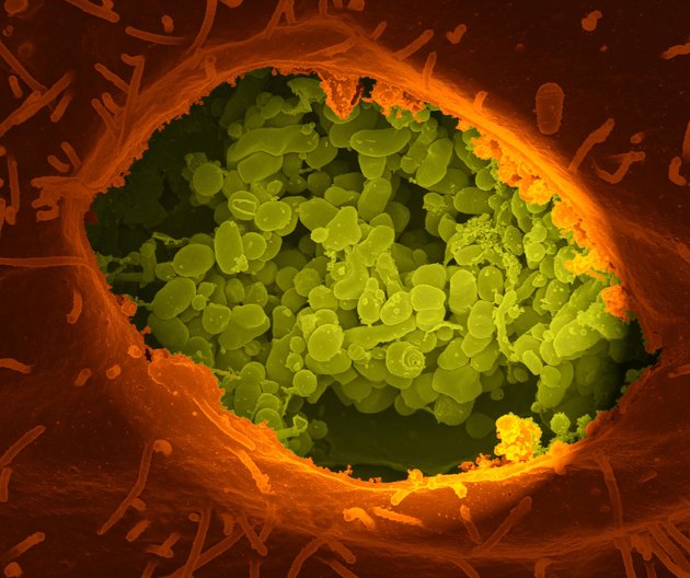 Coxiella burnetii, the bacteria that causes Q Fever.