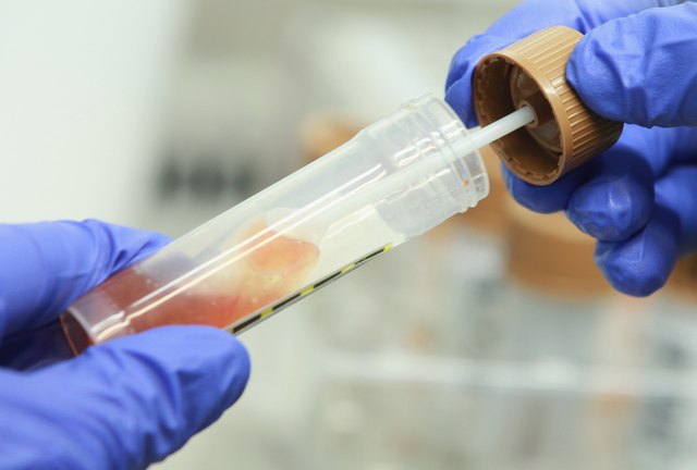 Health Authorities Seek Clues To EHEC Outbreak