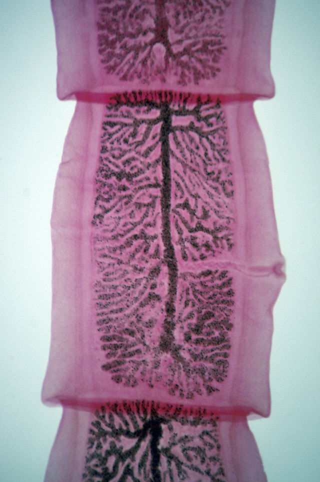 Gravid Proglottid, Dog Tapeworm (Taenia pisiformis), 4X at 35mm. Shows a highly branched uterus with fertilized eggs (zygotes). Remnants of sperm duct, vagina and genital pore still visible. Flatworm, hermaphrodite.