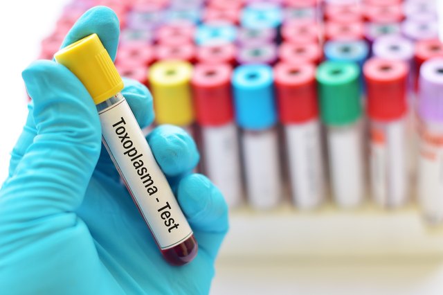 Toxoplasma test