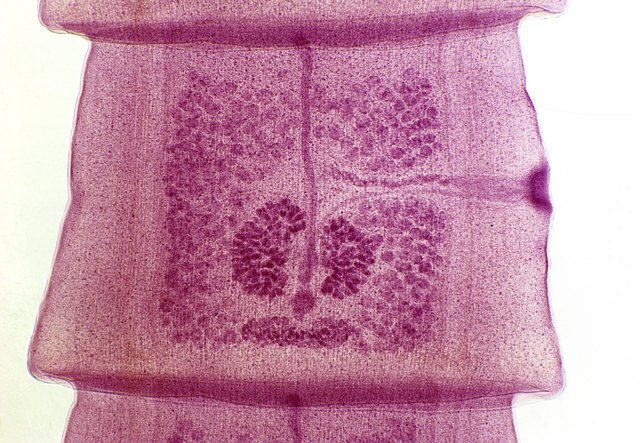 Mature Proglottid, Dog Tapeworm (Taenia pisiformis), 10X at 35mm. Shows: testes, ovary, uterus, yolk gland, shell gland, vagina, sperm duct and genital pore. Flatworm (Phylum Platyhelmintes), hermaphrodite.