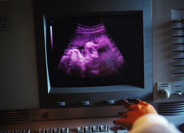 close up of the screen of an ultrasound displaying a foetus